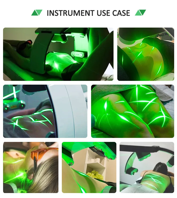 Professional Cold Laser 635nm 532nm Red/Green Light 10D Lipo Slimming Machine Stationary Standing Weight Loss Device