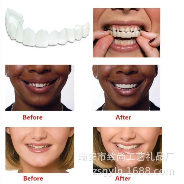Snap Smile Customized  Label Upper and Lower False Teeth Cover Perfect Smile Veneers Comfort Fit Flex Denture Braces