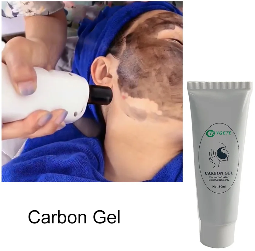 Soft Black Doll Treatment Carbon Gel Facial Nd Yag Cream Carbon Peeling Gel For Laser Carbon Bel