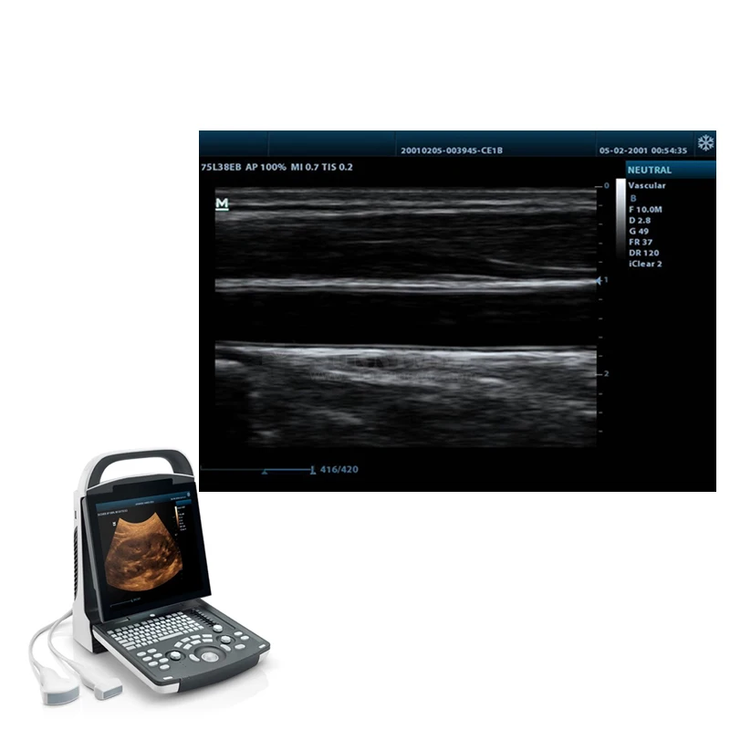 High Quality Medical Ultrasound Machine Mindray DP-20 Potable Digital Ultrasound Device for Abdomen, OB, GYN, Cardiology