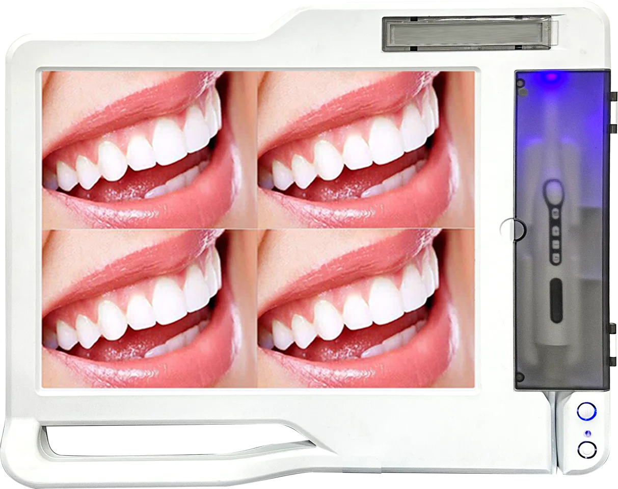 Low Price Dental Intra-Oral Camera with UV Sterilization Built-in Handle with WiFi HD screen Dental Clinic Examination Equipment manufacture