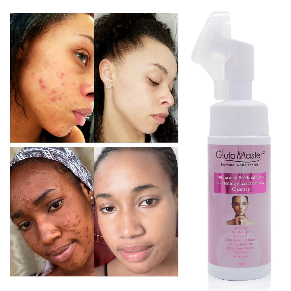 results glutathione injection how many sessions of glutathione drip to see results Glutathione + Vitamin  C IV Drip Results