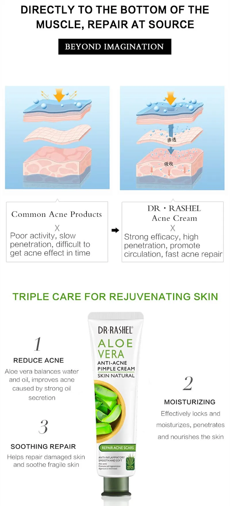 DR.RASHEL aloe vera pimple cream skin natural anti-inflammatory smooth and soft face cream