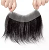 Hair Line