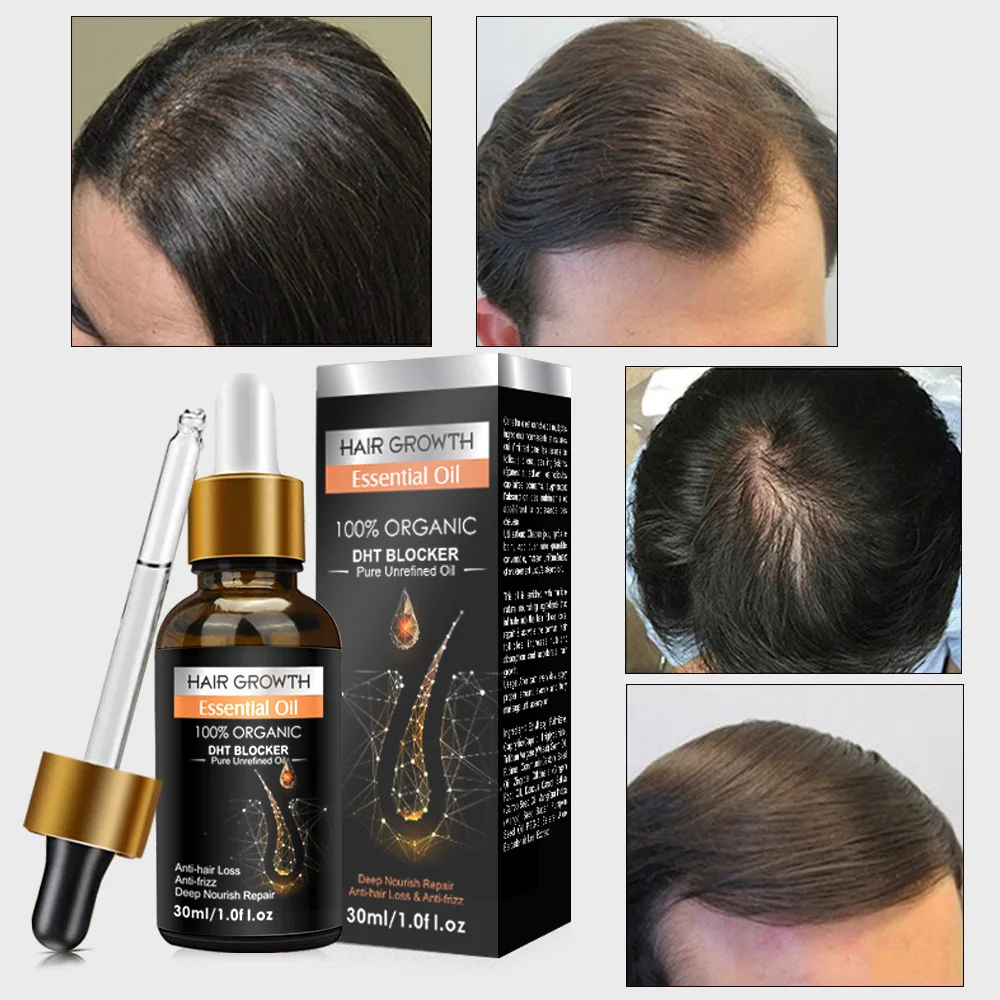 Custom Logo Private Label All Natural Formula Hair Growth Oil Serum Nourishing Scalp Rapid Hair Thickening Oil Organic Hair Oil