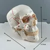Asian skull with bone fissures model