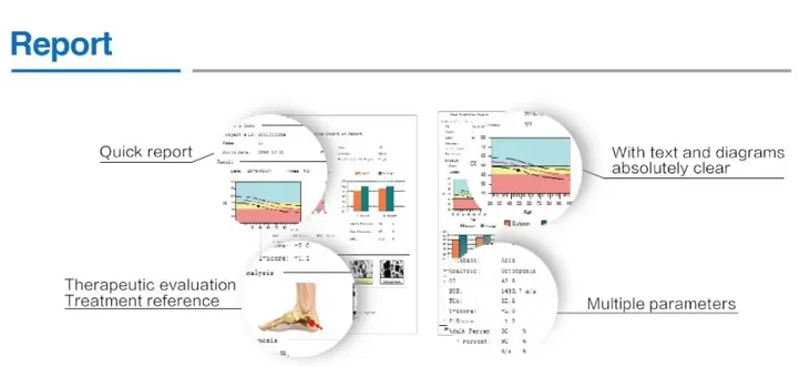 OSTEO KJ3000 Ultrasound Bone Densitometer