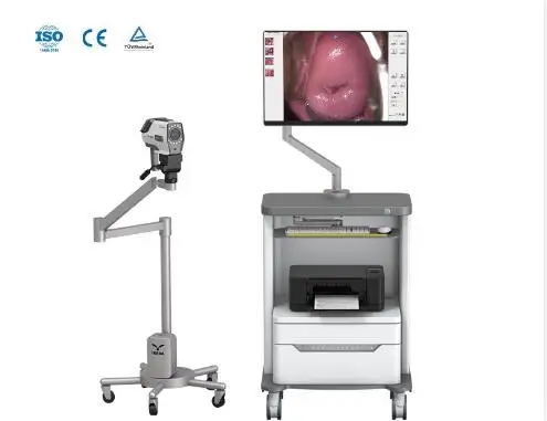 High Resolution Colposcope Video Camera Colposcopy Exam System Digital Colposcope AKX  YKD-3001