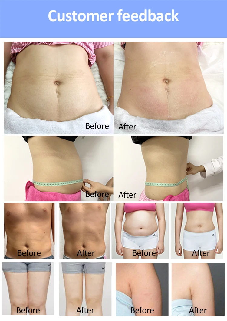 New Technology Vertical 6d Cold Soure Laser Fat Removal Weight Loss With Green Light