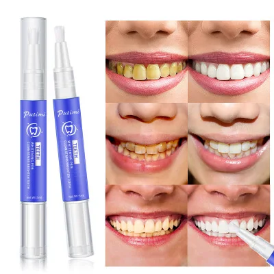 PUTIMI Tooth Care Deep Cleansing Stains Removal Teeth Whitening Pen 5ml