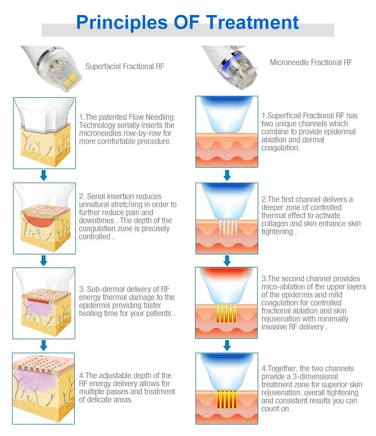 Shop professional RF microneedling replacement cartridges (10 pin, 25 pin, 64 pin, nano). стерile, disposable, compatible with most RF devices. Ideal for skin tightening & acne scars. RF Microneedling Replacement Cartridges 10 25 64 Nano | Professional Disposable Tips