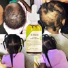 OEM hair growth oil