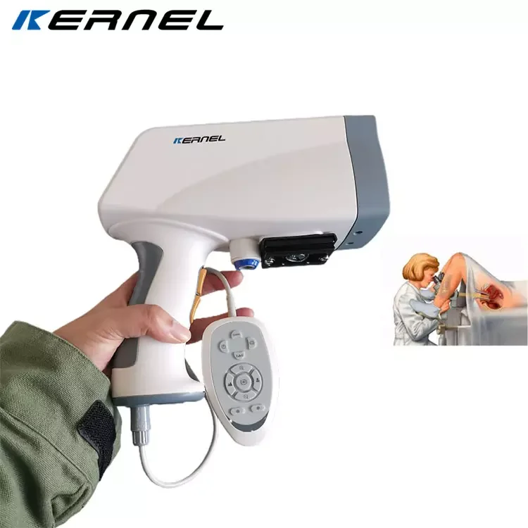 Kernel KN-2200 Hospital Digital Portable Gynecological Colposcope Diagnostic Apparatus Colposcopy Machine for Sale