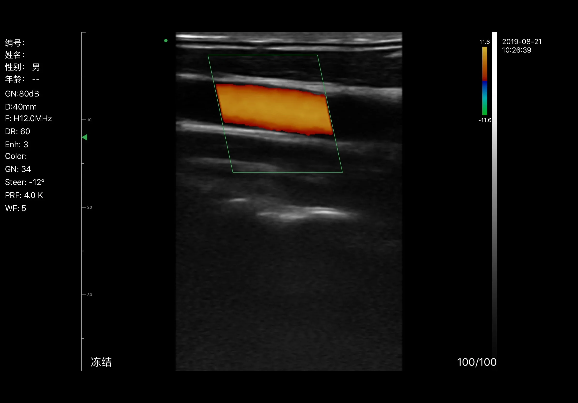 Factory Price Cardiac Sector Phased Array Probe Ultrasonic Ultrasound Linear Probe on Sale manufacture