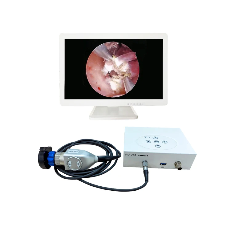 Ent Endoscopic Hd Camera Video Laryngoscope Price Buy Ent Endoscopic Hd Camera,Video