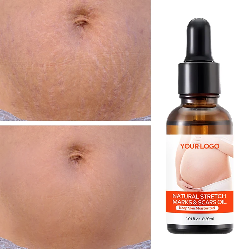 Private Label Natural Marks & Scars Repair Skin Nourishing Smoothing Message Oil Natural Stretch Mark Oil(pic4)