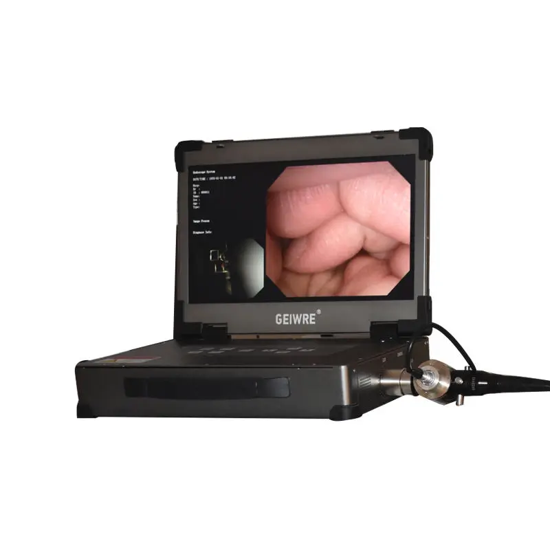 olympus endoscope Video Endoscopy Equipment Gastroscope and Colonoscope System portable 1080p  endoscopy camera details