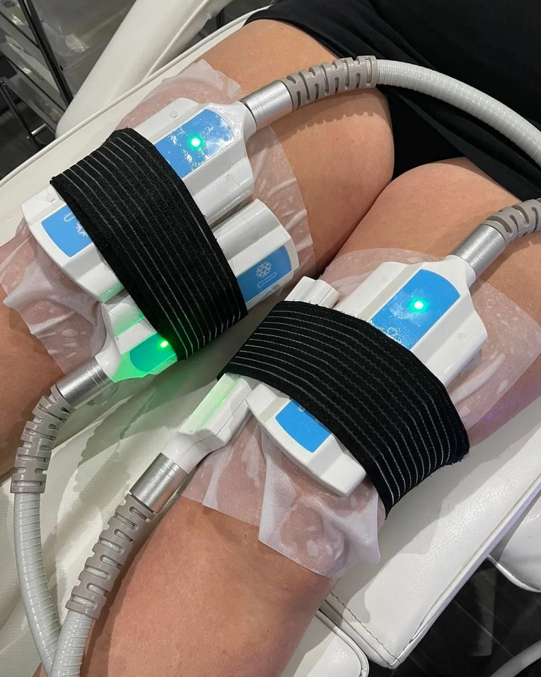 Hot CRIOSTIM Cryoskin CryoSlimming Plates Cryolipolysis Paddles EMS Cryo Tshock Fat Freeze Device