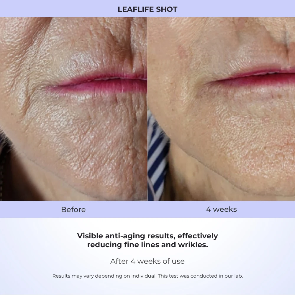 2026 New Innovation 2 in 1 Cold Beauty Plasma Pen for Skin Tightening Wrinkle Removal Acne Removal Cold Plasma Technology