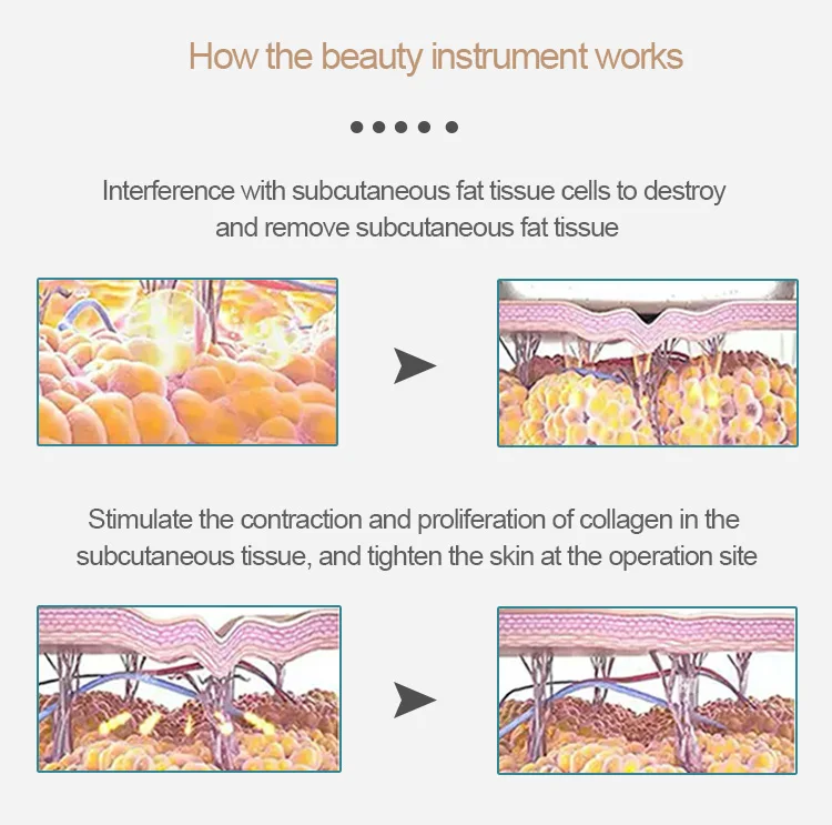 Spa Salon Use Beauty Equipment CET RET TECAR Therapy RF Cellulite Removal Machine