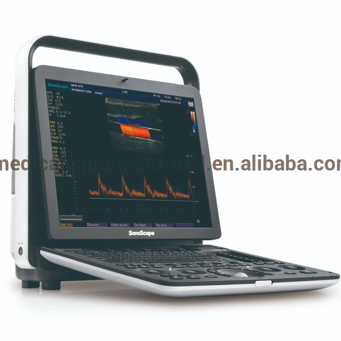 Ce Approved Sonoscape Ultrasound Laptop Sonoscape S9 Ultrasound Machine Price Sonoscape S9pro With Keyboard Buy Sonoscape S9 Ultrasound Machine Price Sonoscape Ultrasound Sonoscape Product On Alibaba Com