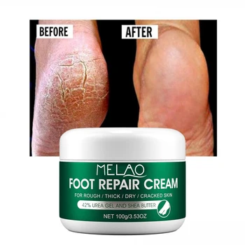 Anti Fungal Foot Repair Foot Cream Dead Skin Removal Peeling