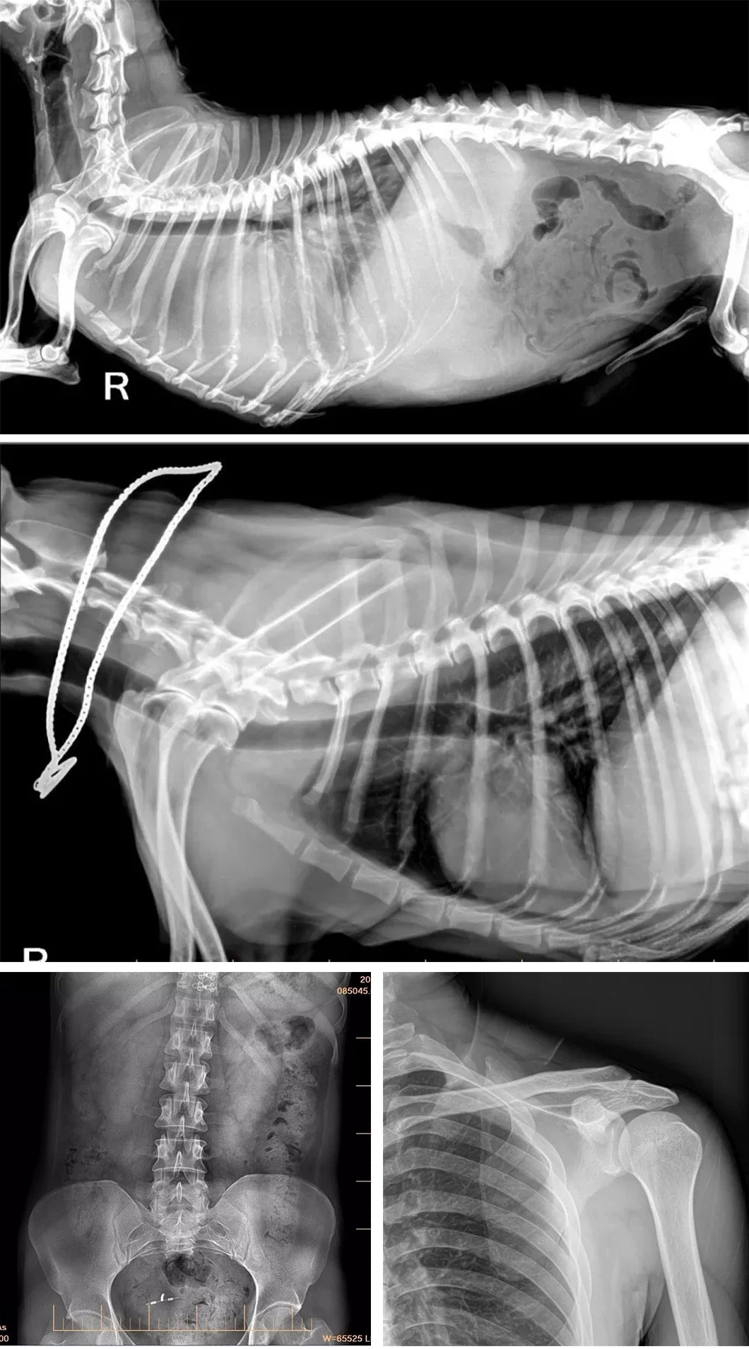 High Quality Medical Surgery Mobile X Ray Wireless Wire Flat Panel Detector for Human Use details