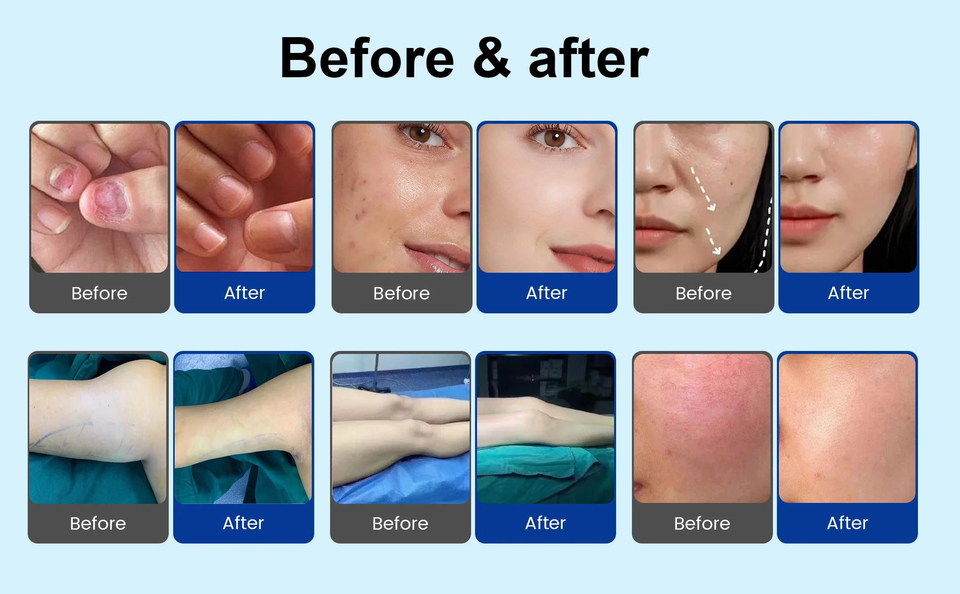 Before and After