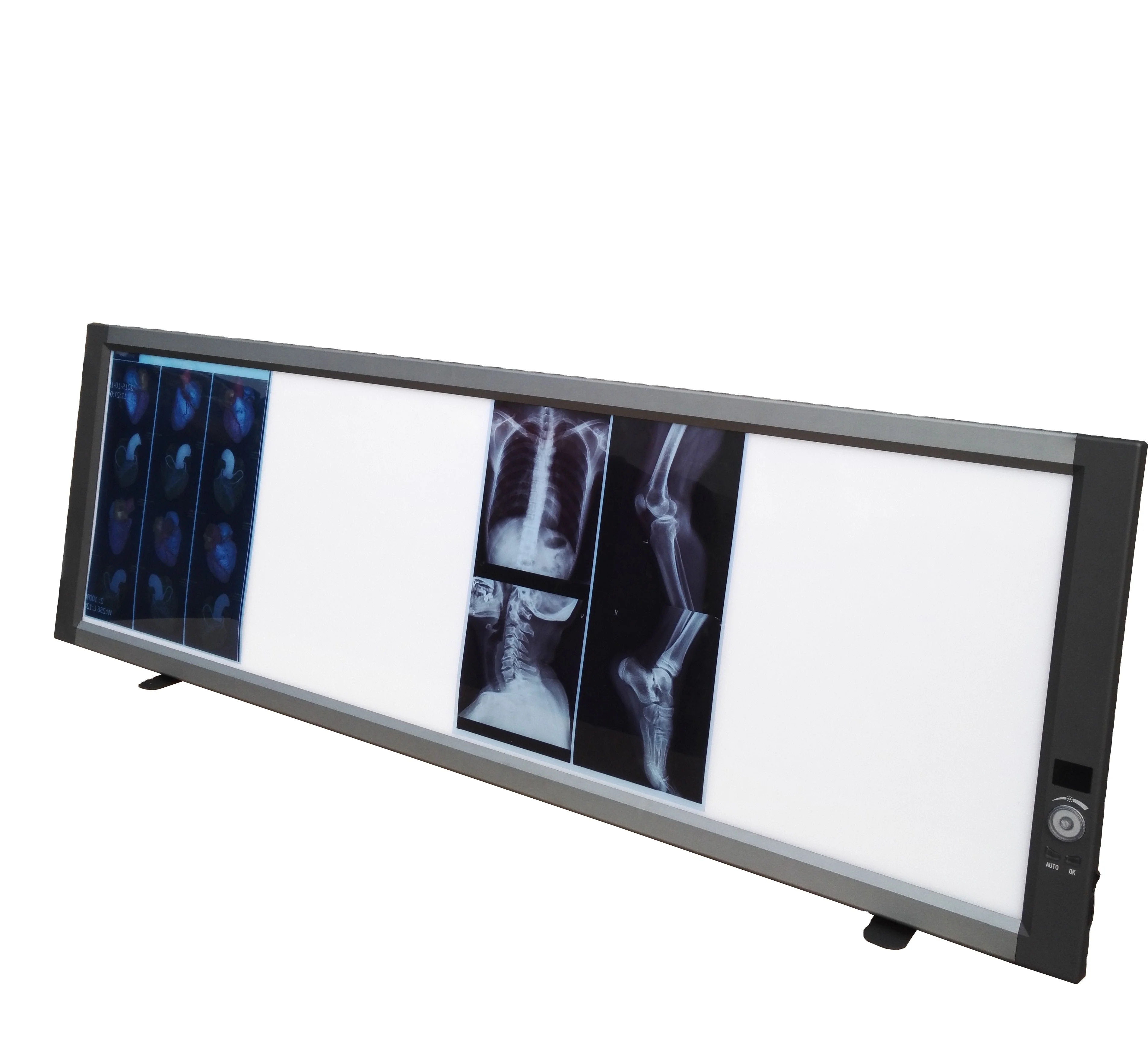 Adjustable Medical X Ray Film Viewer Led Screen Quadruple Negatoscope Led with Sensor