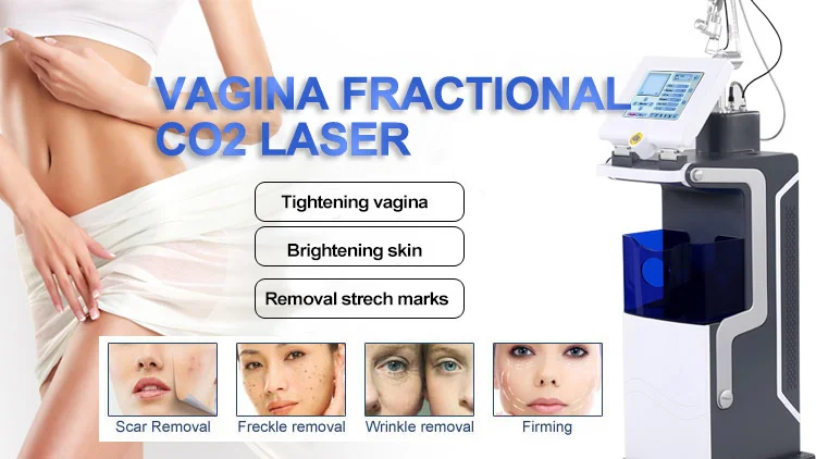 KES RF Tube For Co2 fractional laser machine Scars pimples spots large pores stretch marks Vaginal treatment