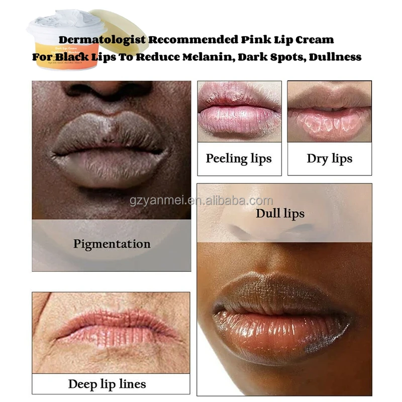 Dermatologist Bleaching Pink Lip Cream Lip Lightening Cream