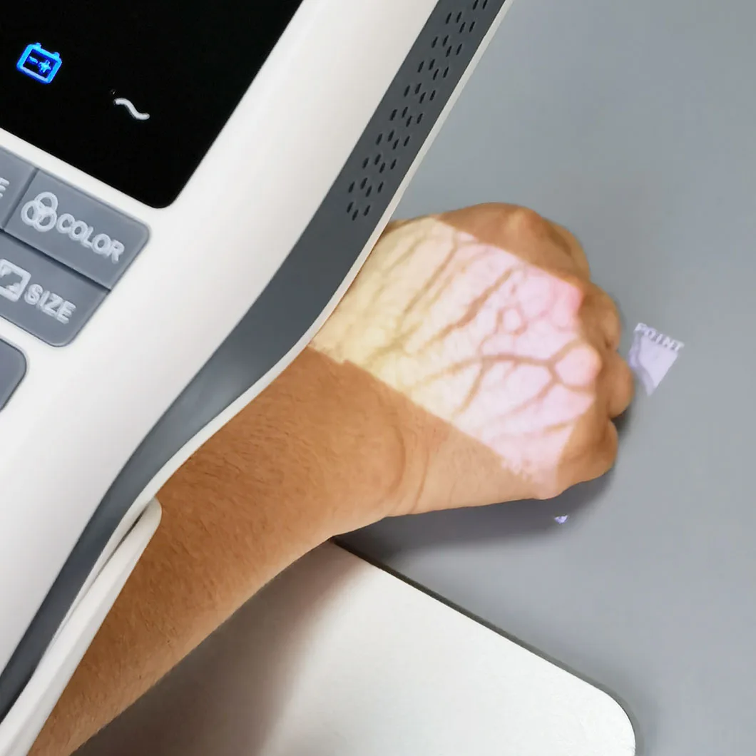 HF-410A Medical High Resolution Multiple Colors Display Handheld Portable Vein Finder Illuminator