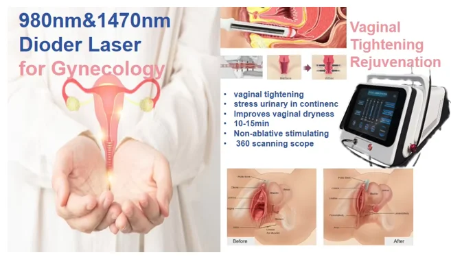 Vaginal olchovlarni onlayn tomosha qiling