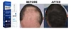 biotin&collagen hair growth