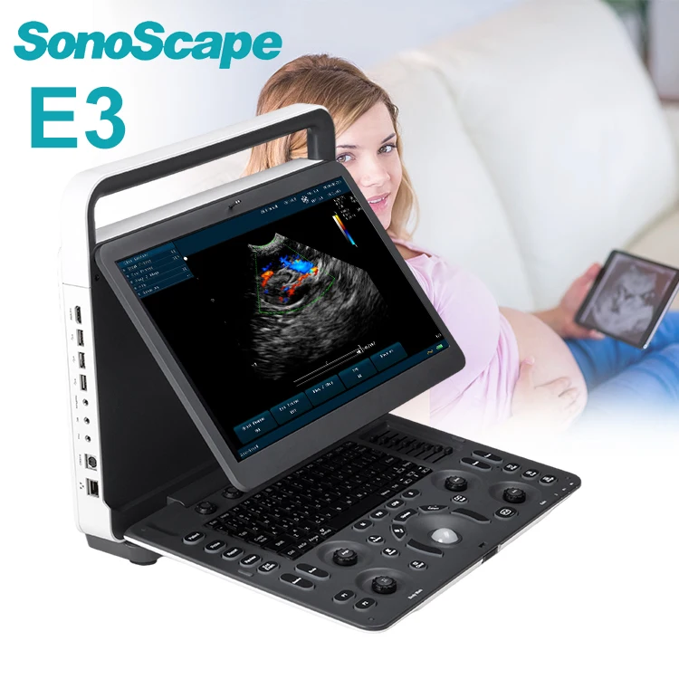 SonoScape E3 Cardiac Vascular Digital Color Doppler Portable Ultrasound Machine