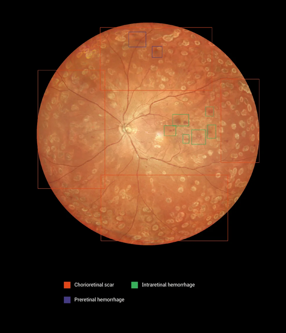 170&deg; Ultra Wide Field Fundus Imaging System Retinal Camera with Four Laser Sources and Automatic Eye Positioning