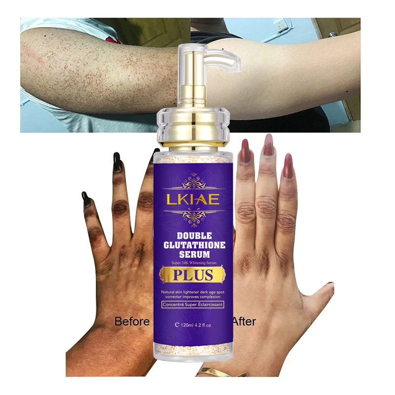 glutathion booster HYDRATION BOOSTER IV DRIP SET – Skin Lab Medical main image 0