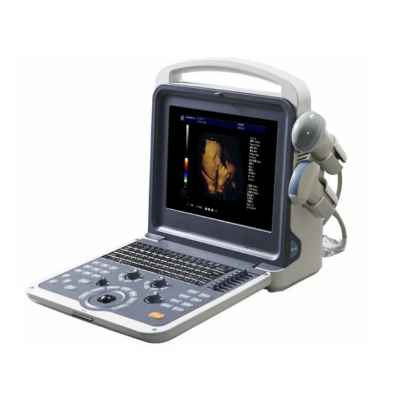RC-K600 Portable Human Ultrasound Scanner Price Medical Ultrasound Instruments Portable 3D 4D Color Doppler Ultrasound Machine-121055