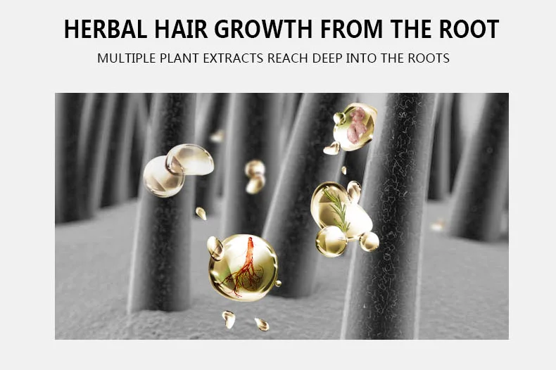 Natural Pure Hair Growth Essential Oil Ginger Hair Growth Oil 30ml