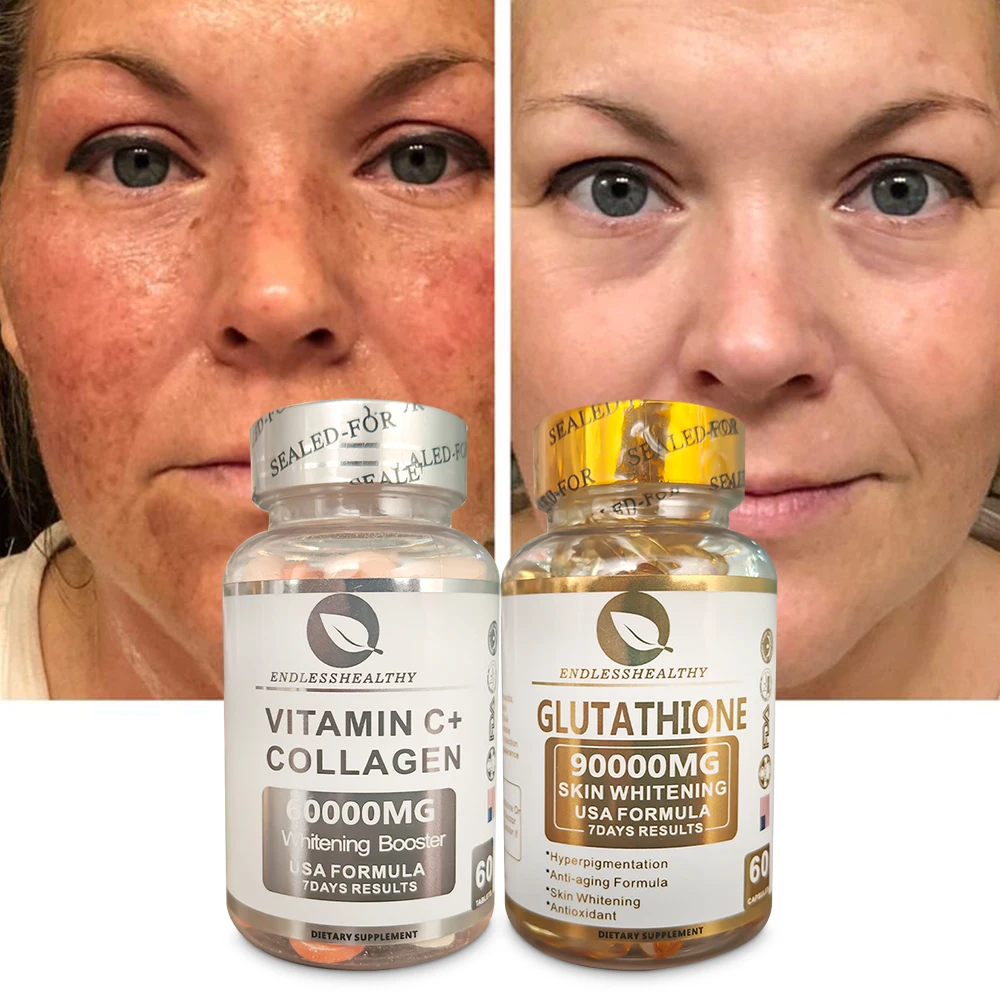 Natural L-Glutathione Skin Whitening Capsules 90000Mg with Vitamin C &  Collagen