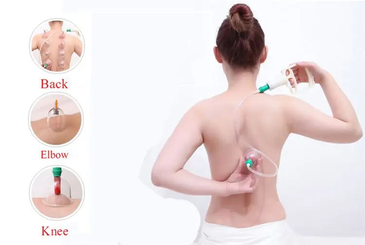 2023 Wholesales Wholesale Facial Hijama 12 Pcs Set Acupuncture Cupping Sets
