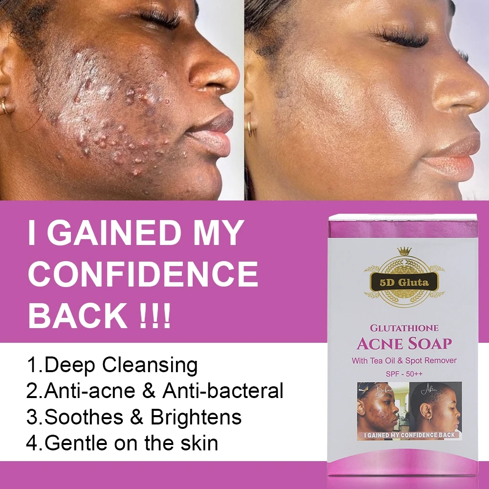 glow bright glutathione side effects Chicnutrix Glow Glutathione tablets for Even-Toned Skin