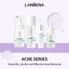 4 pcs Acne pimple sets