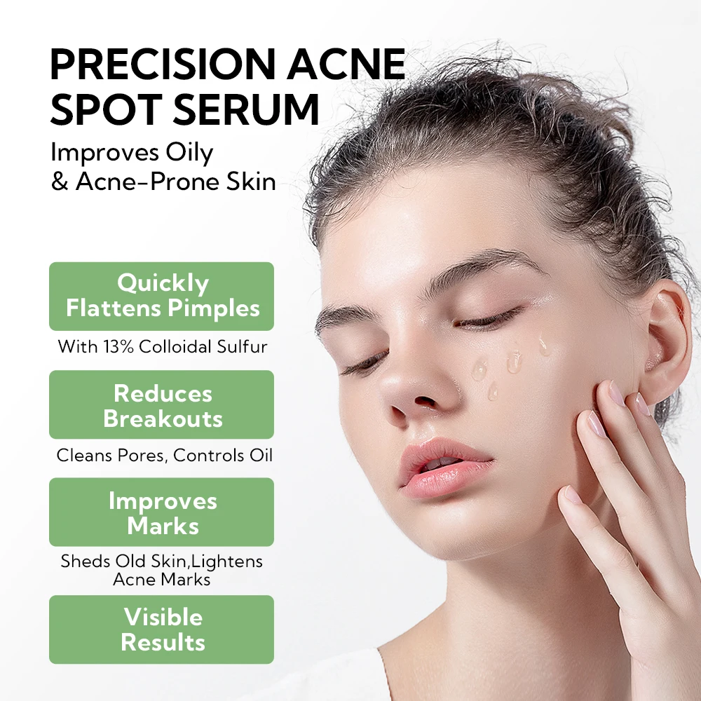 Lanbena Hot Sales Pore Reducing Face Minimizing Face Serum Anti Acnes Cream