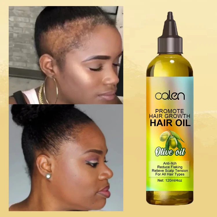 Custom Logo Olive Oil Hair Scalp Oil Organic Natural Scalp Massage Oil