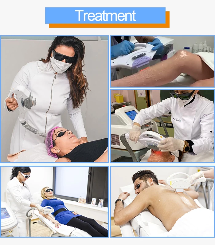 Ipl Hair Removal Machine Professional Ipl Hair Removal  Ipl Laser Pigmentation Manufacturing supplier