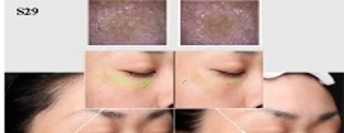 Vhprobi Mix A - High Quality Microbial Fermentation Product