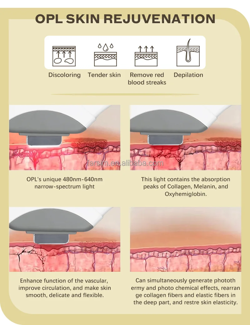 SHR In-Motion Treatment Precision
