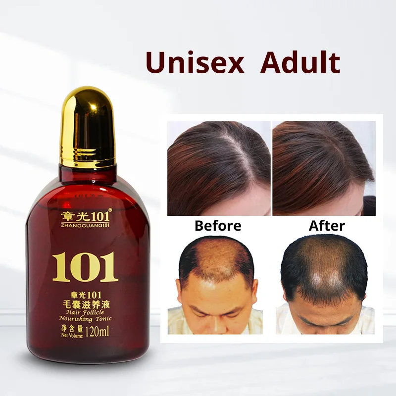 Частная этикетка лечение алопеции Сыворотка для роста волос для ЛЫСЫХ волос