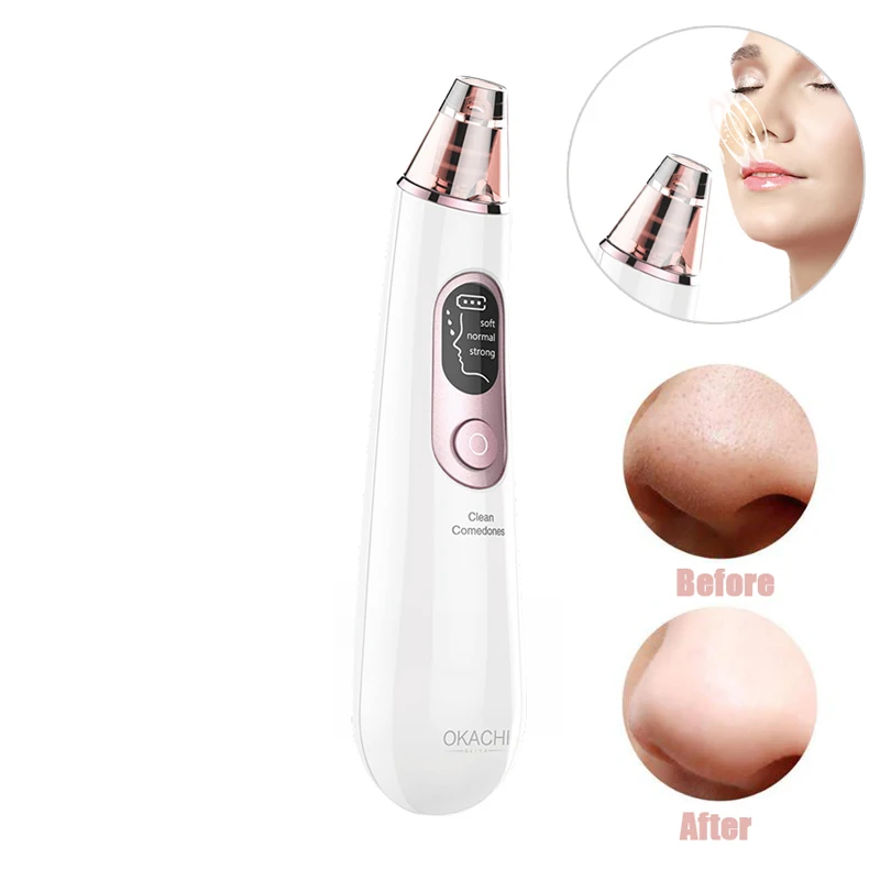 best selling beauty equipment portable electric rechargeable facial pore cleaner suction vacuum blackhead remover tool kit